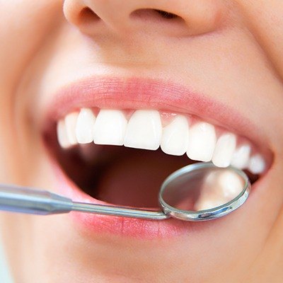 Closeup of healthy smile during dental exam