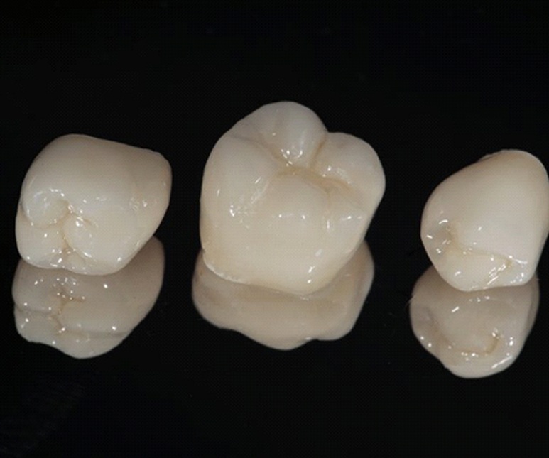 three dental crowns in McKinney against black background