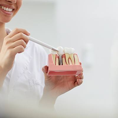 McKinney implant dentist holding model of implants and talking with patient