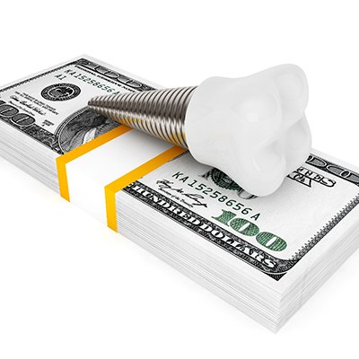 Model implant and money stack symbolizing the cost of dental implants in McKinney