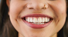 Close up of woman smiling with discrete Invisalign aligners 