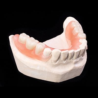 Model smile with partial denture