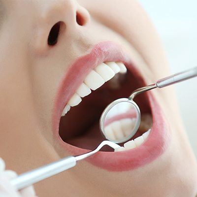 Closeup of smile during dental exam