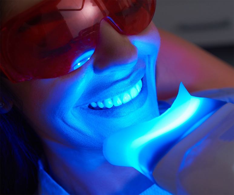 person getting their teeth whitened