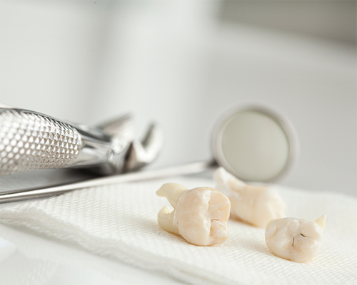 Wisdom teeth lying on paper towel next to dental instruments