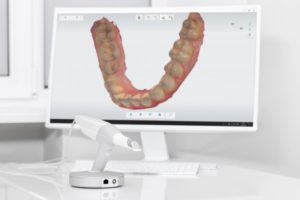 Scanning wand and digital impression at dentist in Frisco’s office