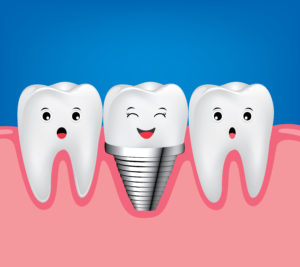 dental implant and normal tooth illustration 